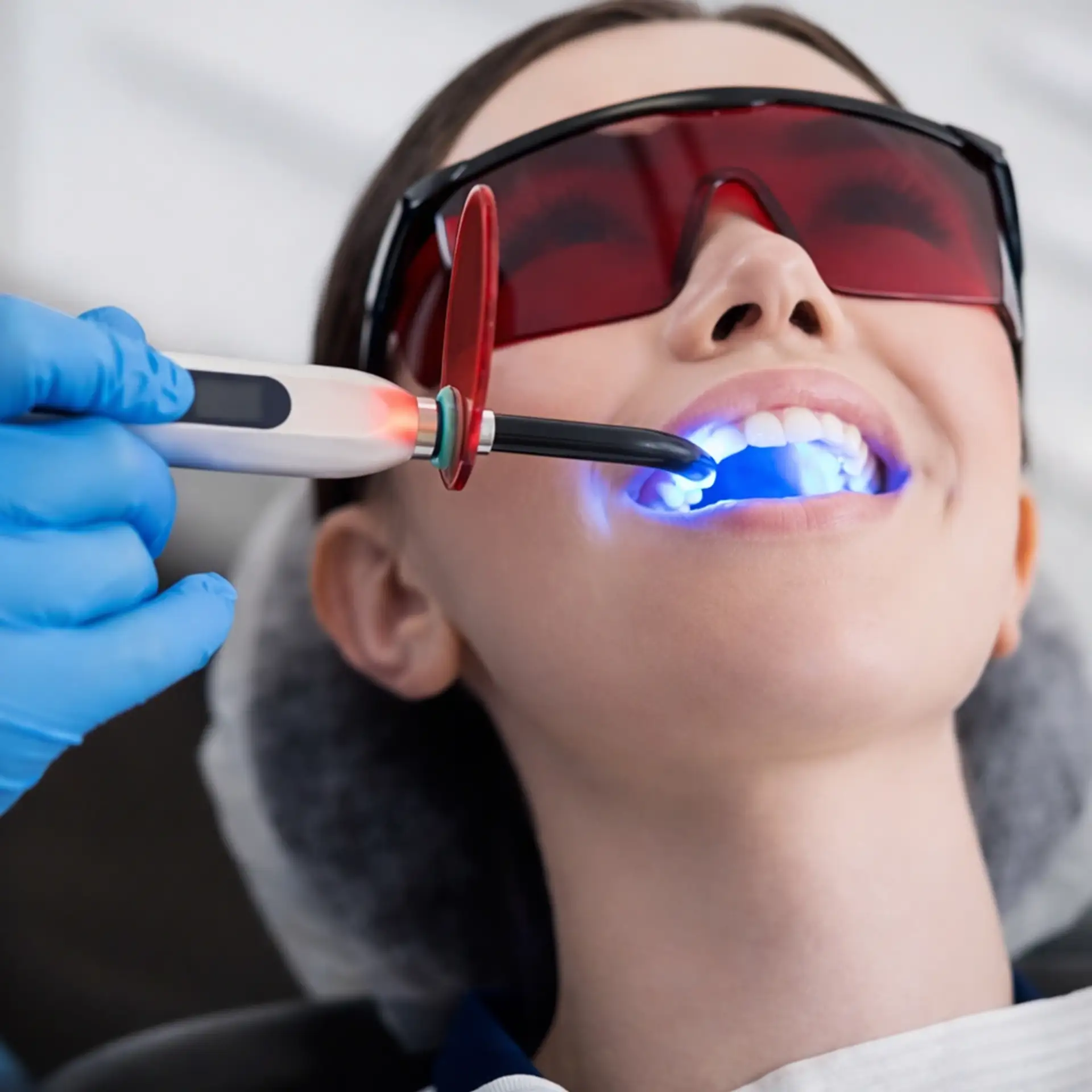 teeth-whitening-in-turkey