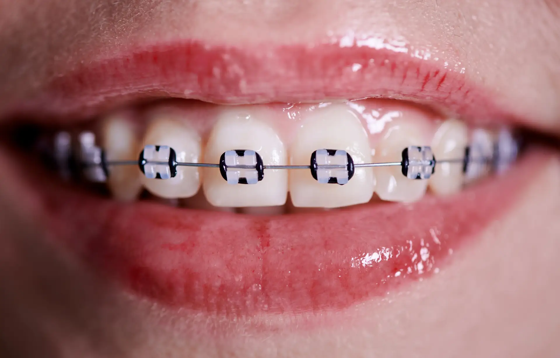 complete-orthodontic
