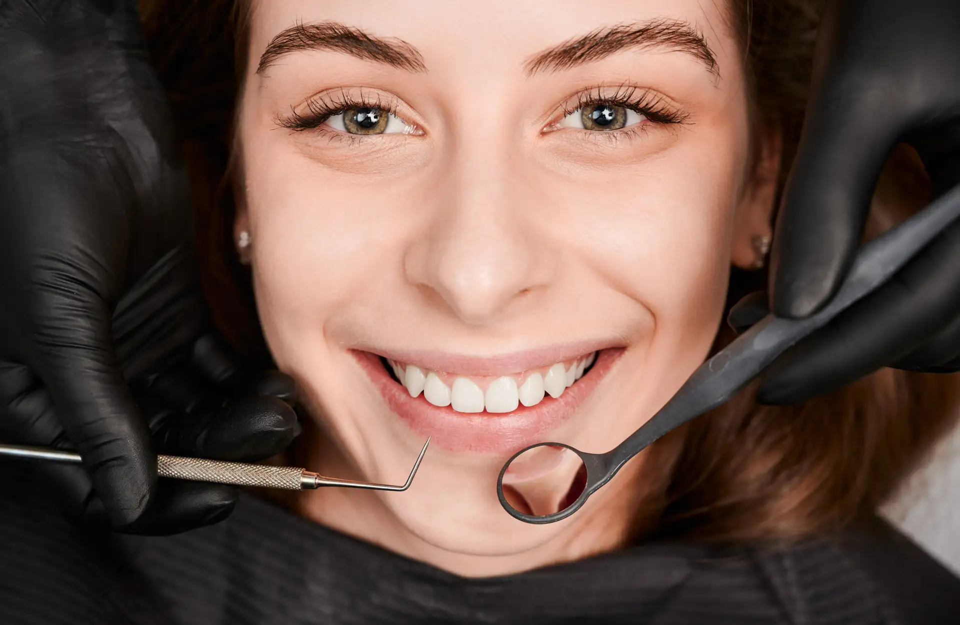 cost-of-e-max-veneers-in-turkey
