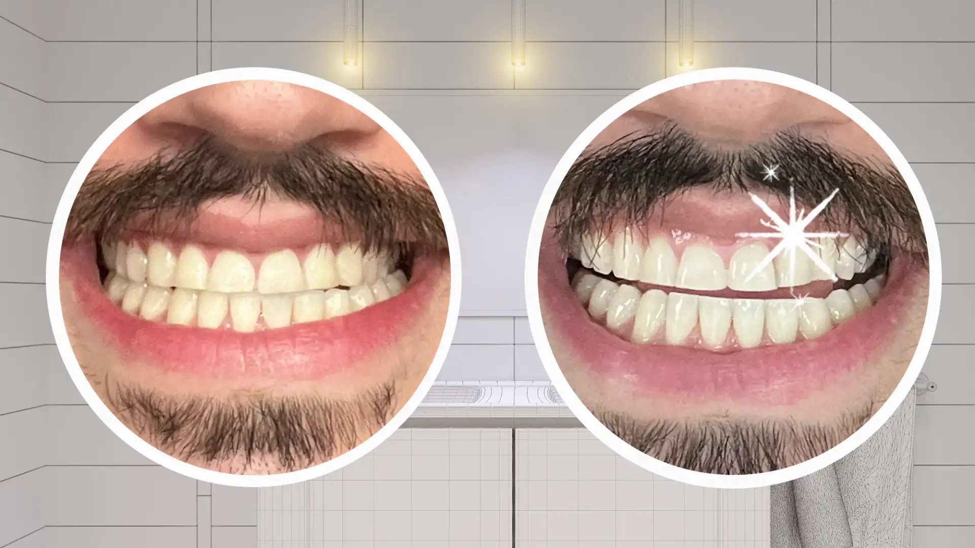 Crest Teeth Whitening: A Professional Evaluation