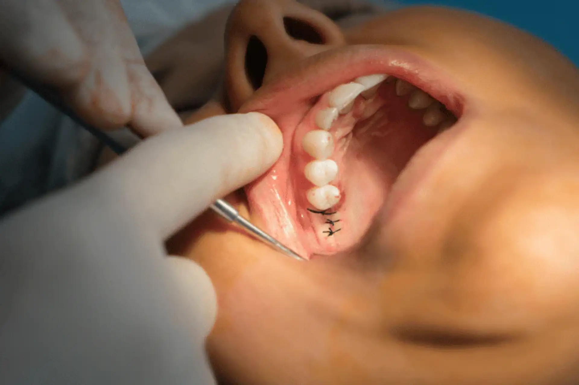 Surgical Treatments
