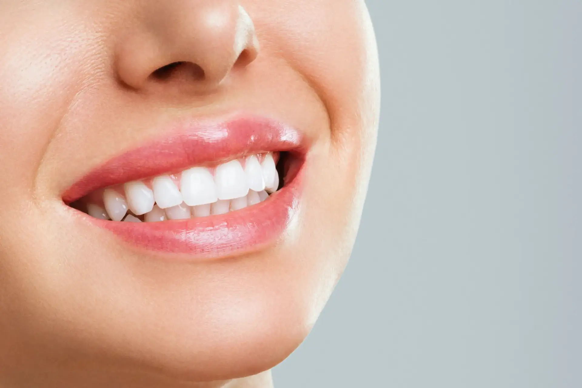 smile design