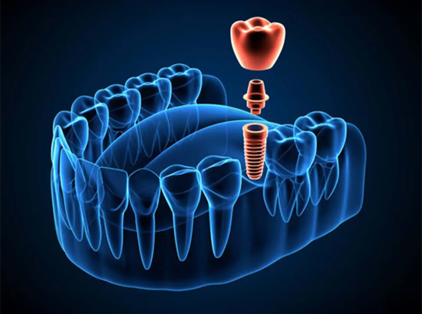 Istanbul Care Dental