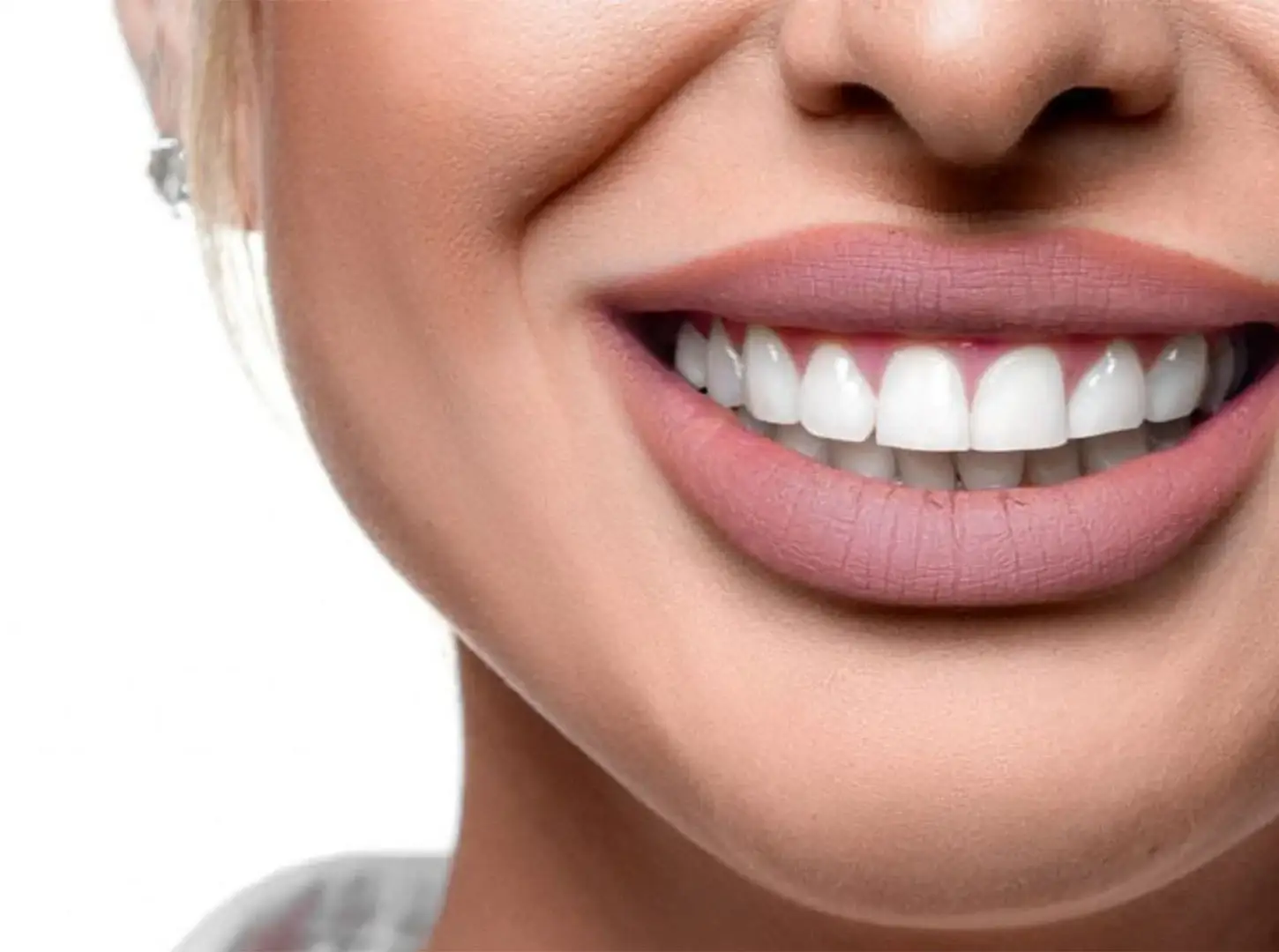 what-type-dental-implant