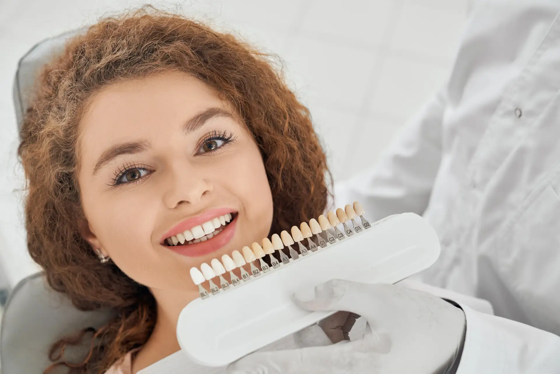 what-are-e-max-veneers