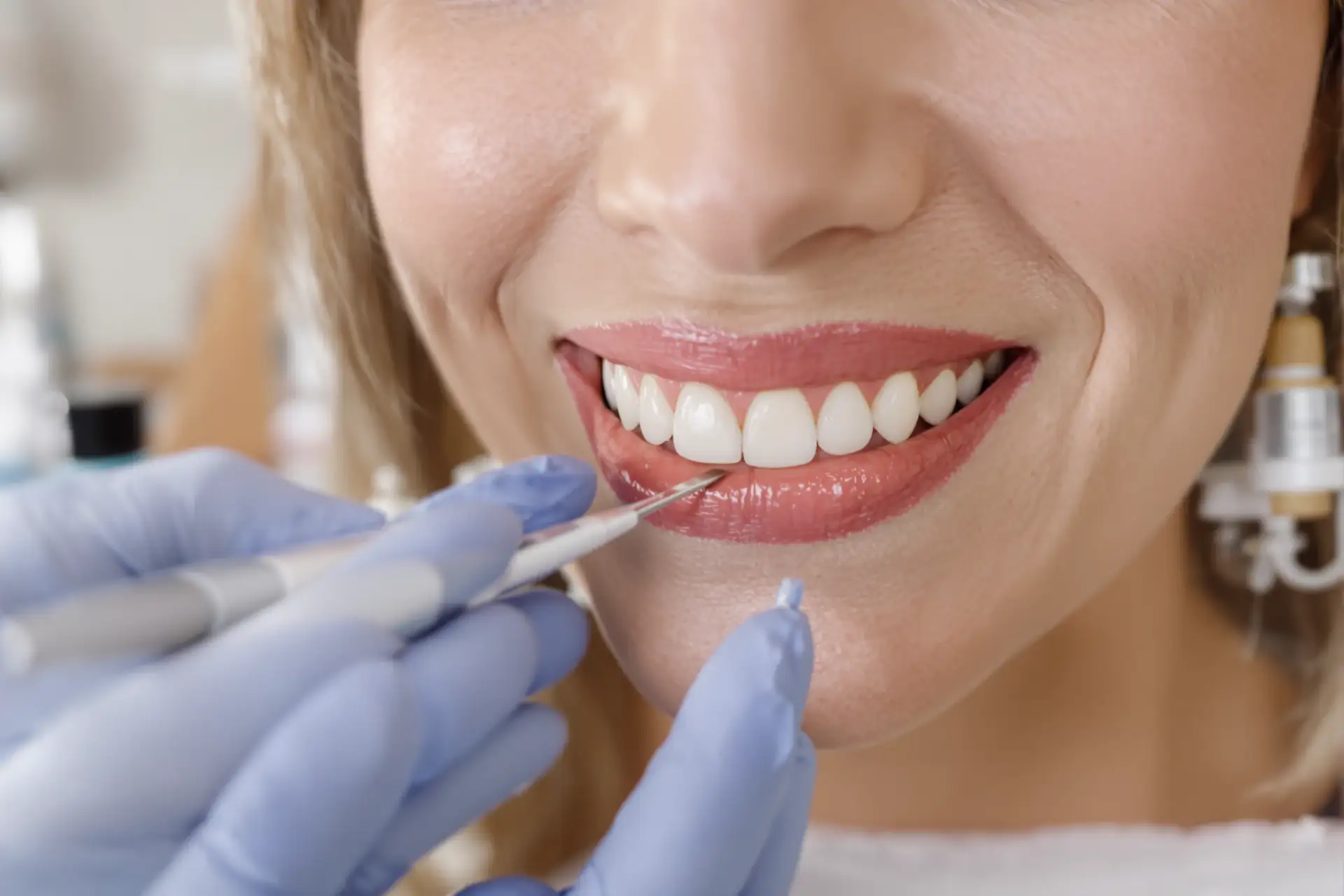 How Long Do Turkey Teeth Last? Lifespan by Treatment Type