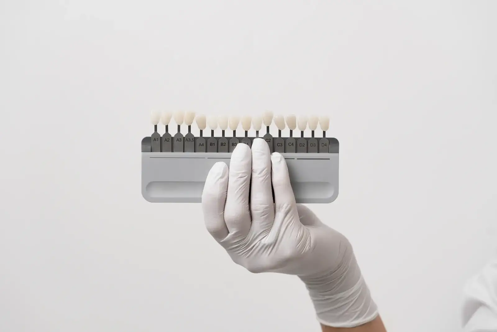 Veneers vs Bonding: Which UK Option Suits You?