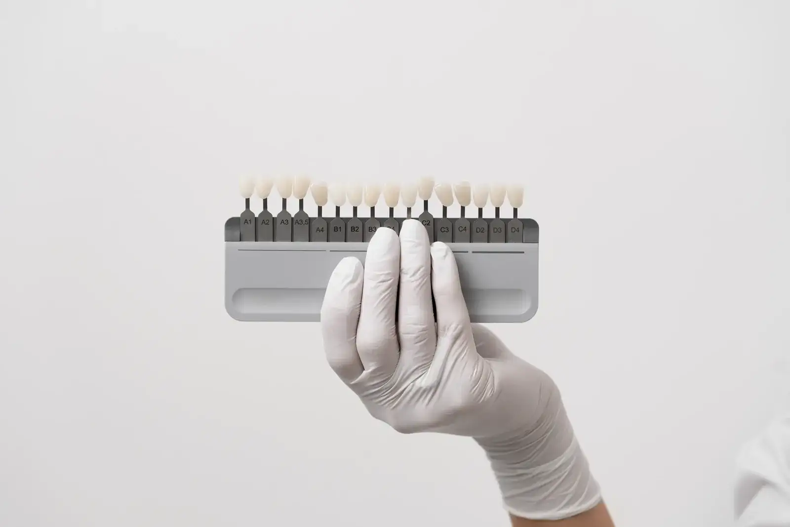 Crowns on Front Teeth: Material Choice, Aesthetics and When a Veneer Is Better