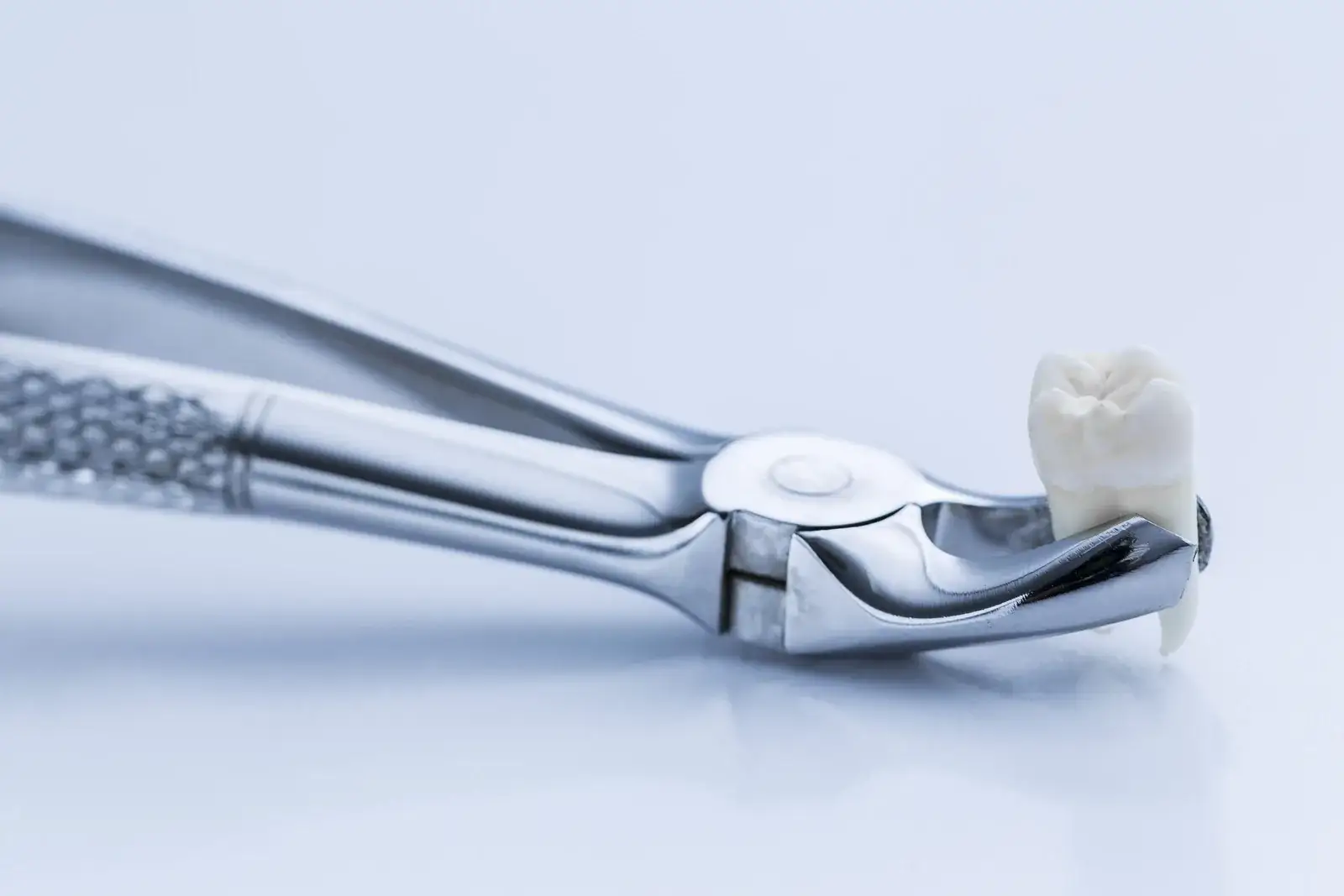 Surgical Tooth Extraction: Procedure, Pain and Recovery
