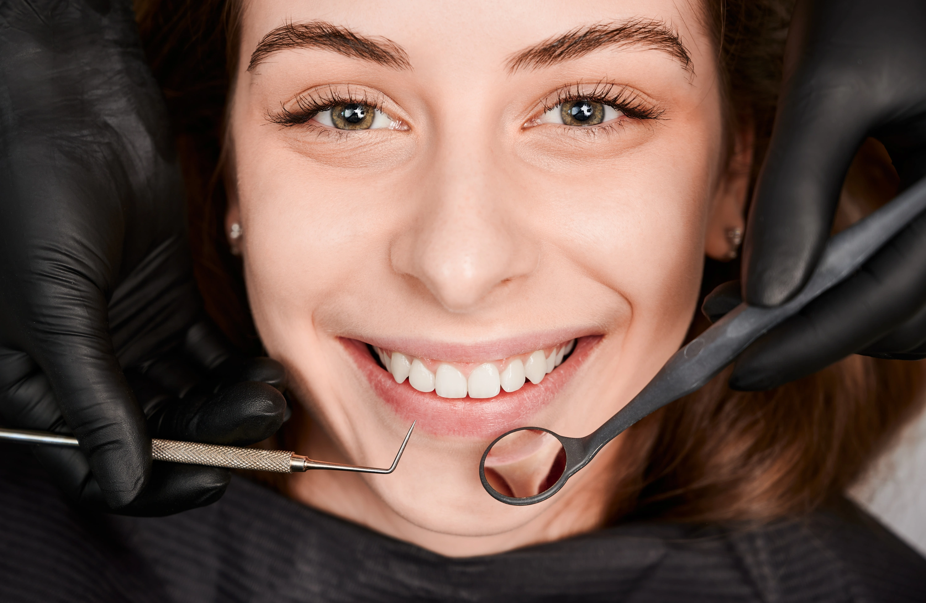 Dentist checking a patient's veneers during a dental examination