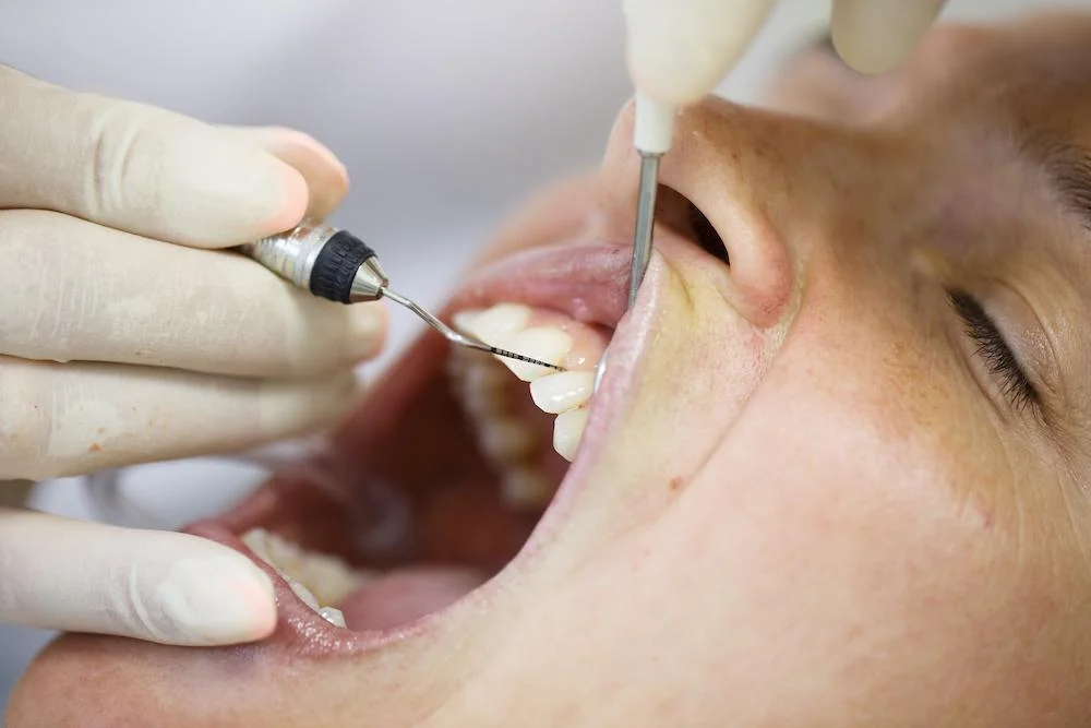 Fixing Gum Recession