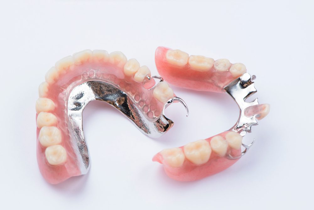 Lower Partial Denture- Design and Material Options