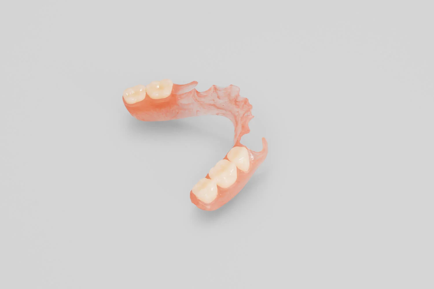 Lower Partial Denture: Design and Material Options