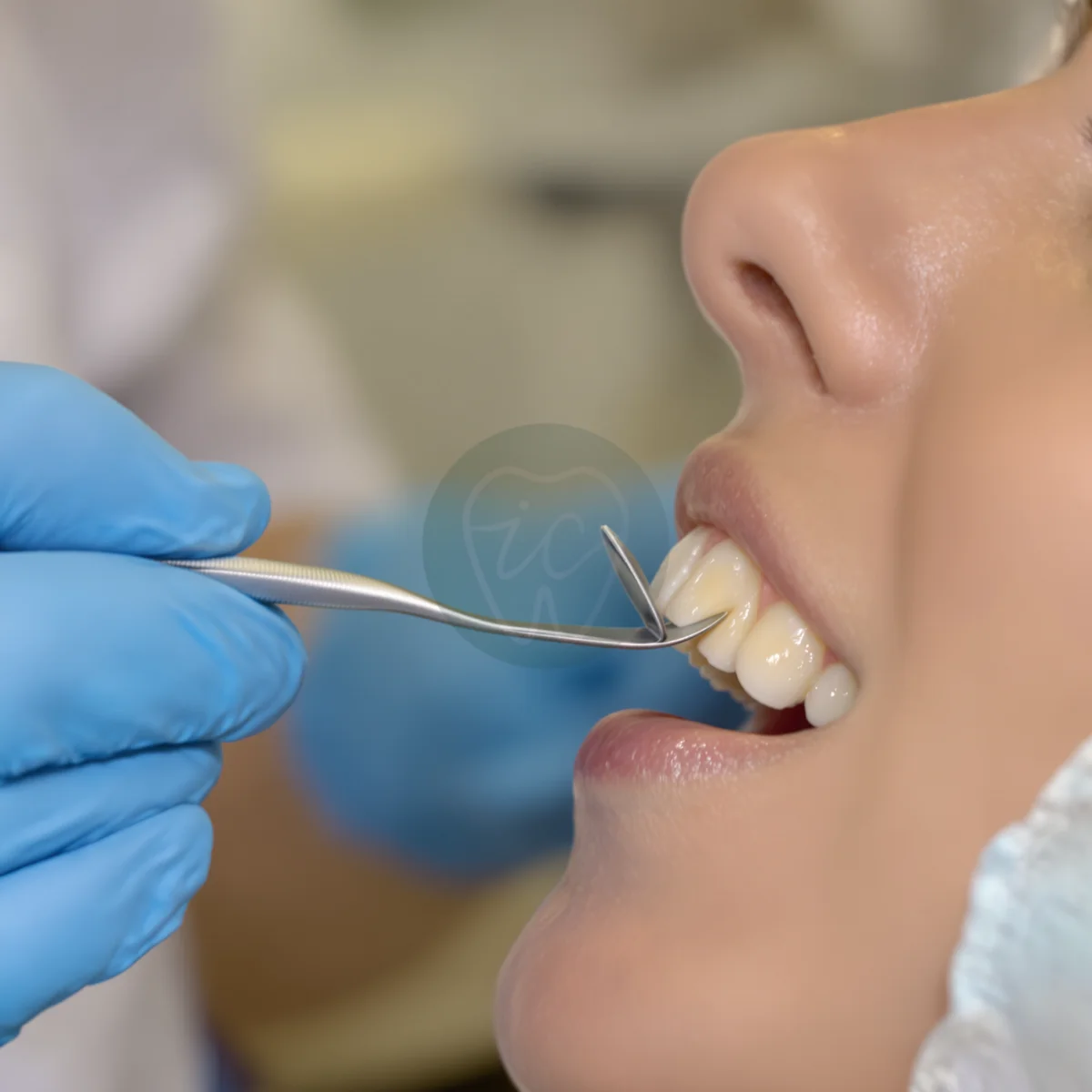 Dentist examining a patient's front teeth with a mirror instrument to grade the severity of a chipped tooth – IC Dental, Istanbul